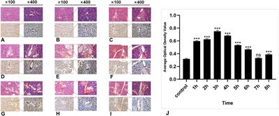 The single-strand DNA-binding protein SSB1 is involved in the expression of salivary gland radiation injury repair